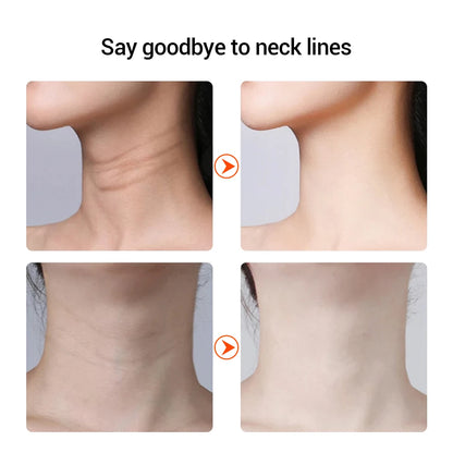 EMS Neck & Chin Lifting Device – Anti-Wrinkle & Firming - DELEOUR